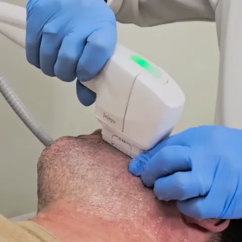 Imagem do Tratamento